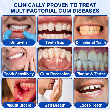 🇺🇸Pureluxo® 🦷GumRevive periodontal repair gel🔥