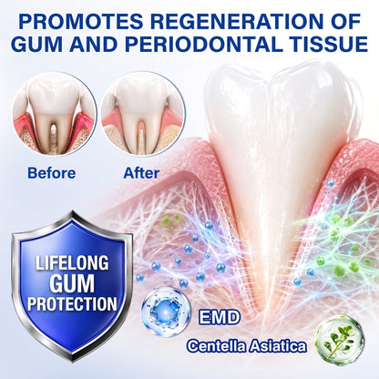 🇺🇸Pureluxo® 🦷GumRevive periodontal repair gel🔥