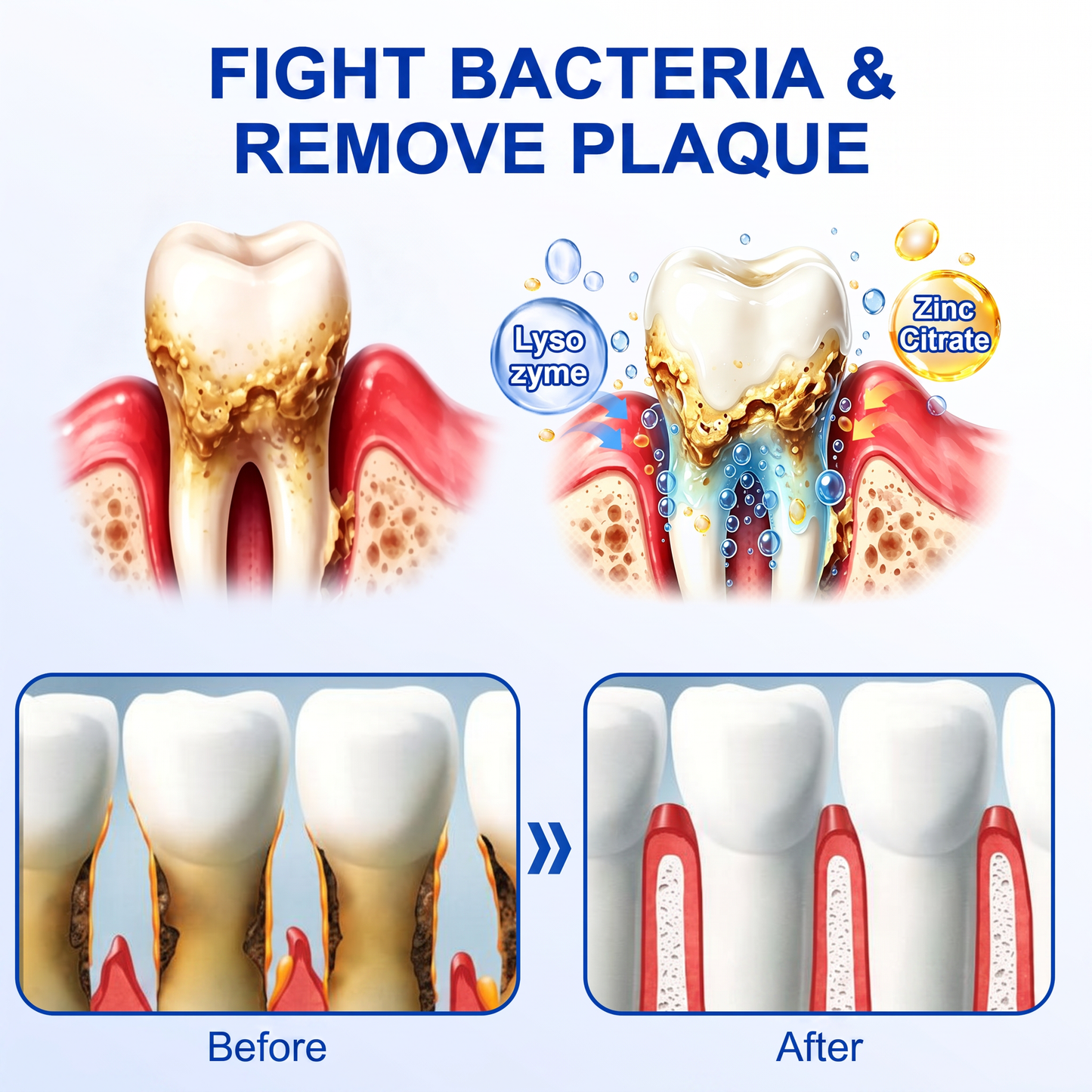 🇺🇸Pureluxo® 🦷GumRevive periodontal repair gel🔥