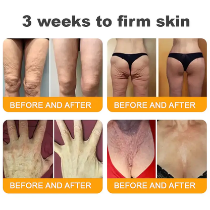 Made and Shipped from USA ✨ Pureluxo® Bee Venom Skin Restoration Cream ⏰ LAST DAY 80% OFF🛒