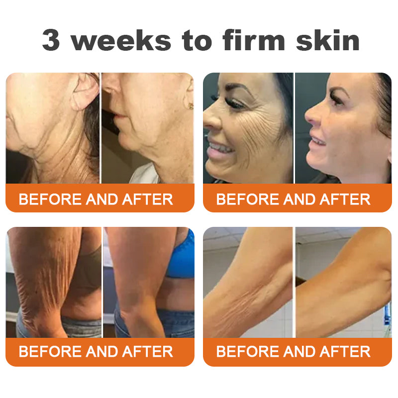 Made and Shipped from US✨Pureluxo® Botox Bee Venom Firming Serum Stick(🔥LAST DAY 70% OFF) 🛒