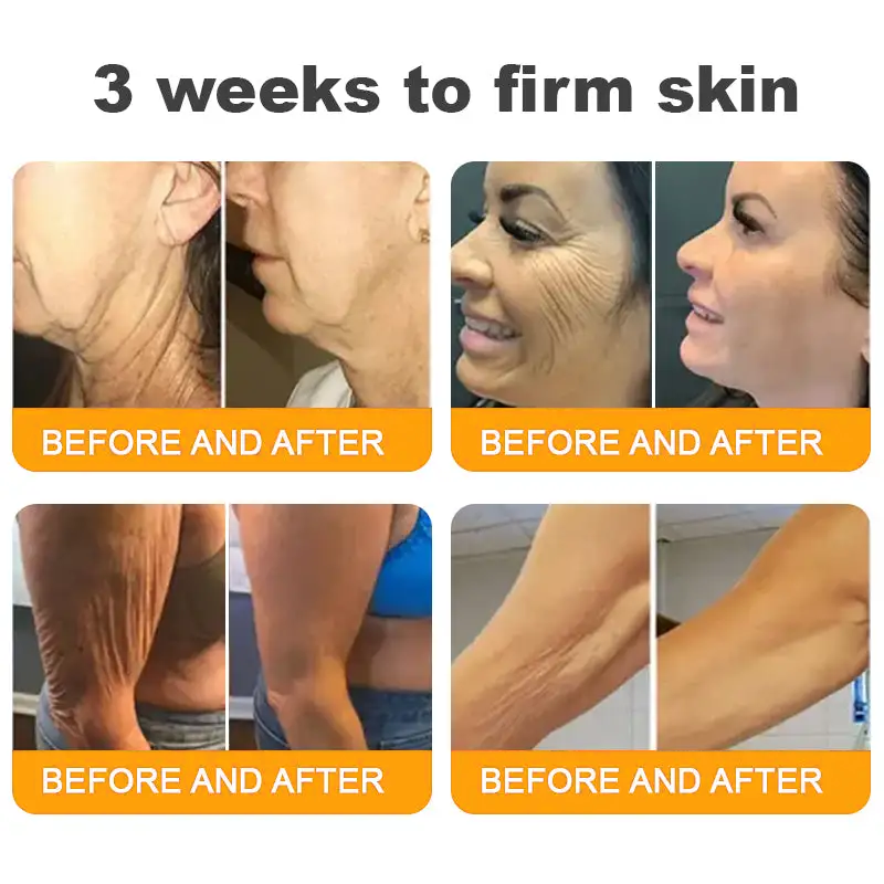 Made and Shipped from USA ✨ Pureluxo® Bee Venom Skin Restoration Cream ⏰ LAST DAY 80% OFF🛒