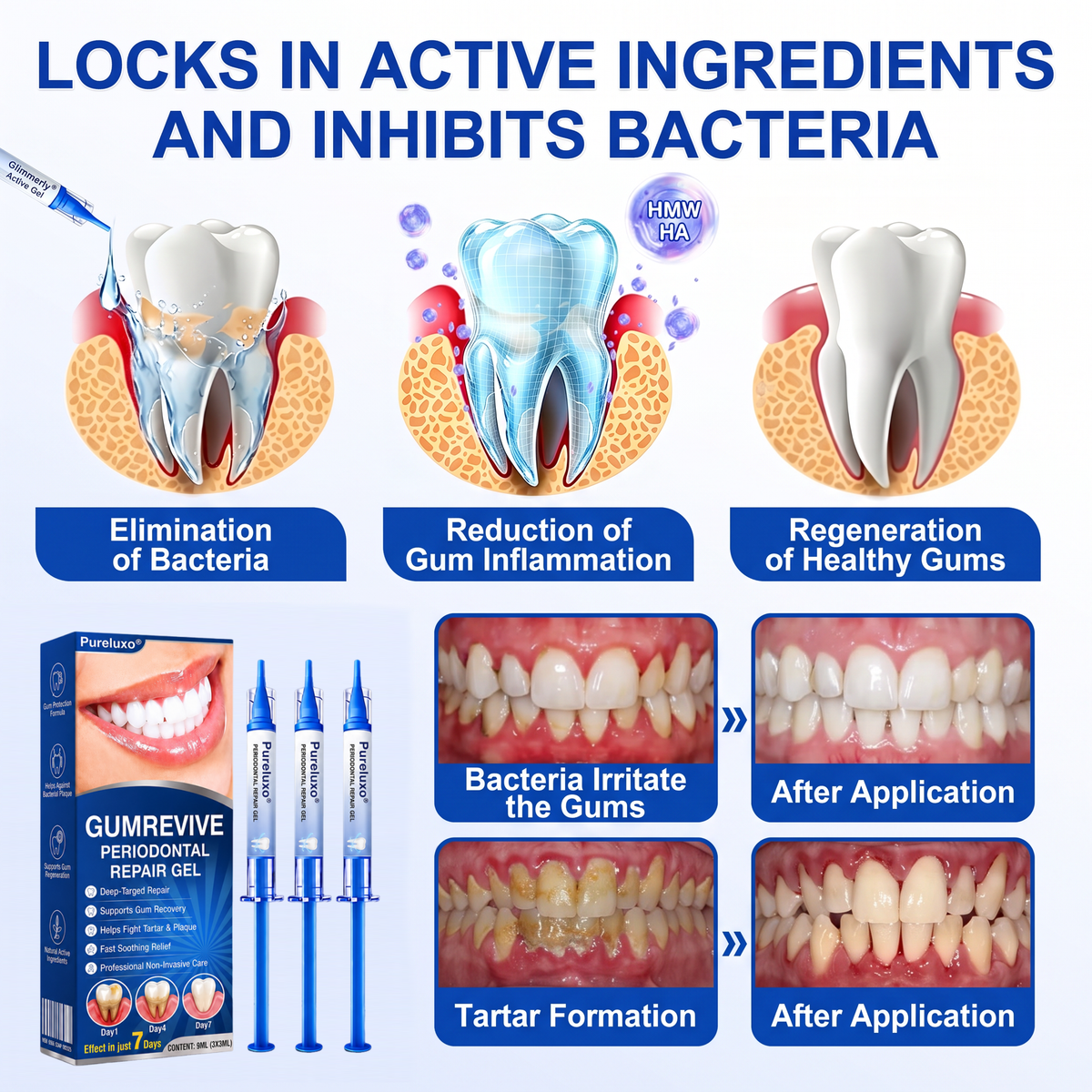 🇺🇸Pureluxo® 🦷GumRevive periodontal repair gel🔥