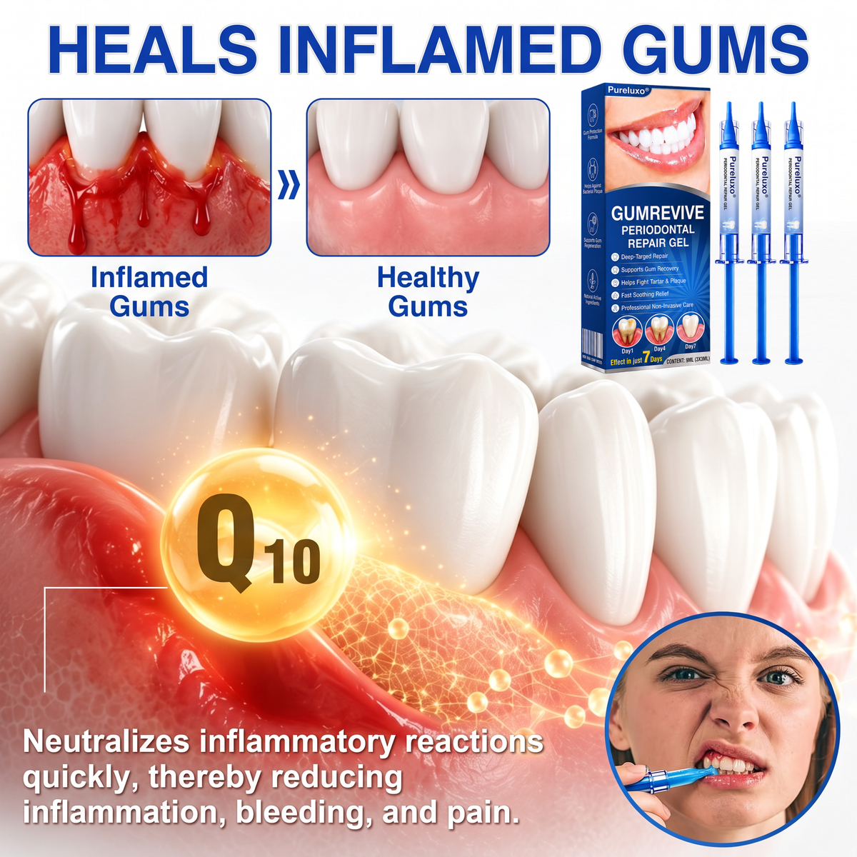 🇺🇸Pureluxo® 🦷GumRevive periodontal repair gel🔥
