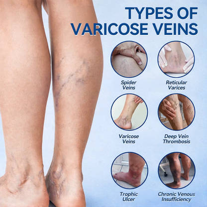 𝐏𝐮𝐫𝐞𝐥𝐮𝐱𝐨® 𝗩𝗲𝒊𝒏 𝐂𝒐𝒏𝘁𝗼𝐮𝐫 𝐌𝐢𝐜𝐫𝐨𝒏𝒆𝒆𝒅𝗹𝗲 𝑷𝒂𝒕𝐜𝐡 (𝐉𝐮𝐬𝐭 𝐎𝐧𝐜𝐞 𝐀 𝐃𝐚𝐲, 𝐒𝐞𝐞 𝐑𝐞𝐬𝐮𝐥𝐭𝐬 𝐈𝐧 𝟕 𝐃𝐚𝐲𝐬) — 👩‍⚕️🏆 𝐒𝐮𝐢𝐭𝐚𝐛𝐥𝐞 𝐅𝐨𝐫 𝐕𝐚𝐫𝐢𝐜𝐨𝐬𝐞 𝐕𝐞𝐢𝐧𝐬 𝐀𝐧𝐝 𝐒𝐩𝐢𝐝𝐞𝐫 𝐕𝐞𝐢𝐧𝐬, 𝐑𝐞𝐥𝐢𝐞𝐯𝐞𝐬 𝐇𝐞𝐚𝐯𝐲, 𝐓𝐢𝐫𝐞𝐝 𝐋𝐞𝐠🛒