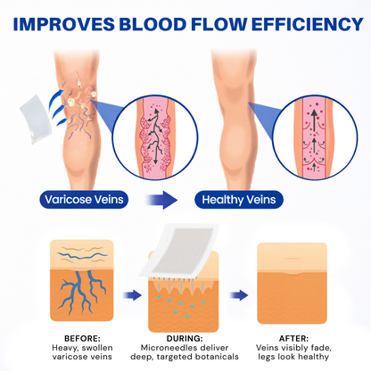 𝐏𝐮𝐫𝐞𝐥𝐮𝐱𝐨® 𝗩𝗲𝒊𝒏 𝐂𝒐𝒏𝘁𝗼𝐮𝐫 𝐌𝐢𝐜𝐫𝐨𝒏𝒆𝒆𝒅𝗹𝗲 𝑷𝒂𝒕𝐜𝐡 (𝐉𝐮𝐬𝐭 𝐎𝐧𝐜𝐞 𝐀 𝐃𝐚𝐲, 𝐒𝐞𝐞 𝐑𝐞𝐬𝐮𝐥𝐭𝐬 𝐈𝐧 𝟕 𝐃𝐚𝐲𝐬) — 👩‍⚕️🏆 𝐒𝐮𝐢𝐭𝐚𝐛𝐥𝐞 𝐅𝐨𝐫 𝐕𝐚𝐫𝐢𝐜𝐨𝐬𝐞 𝐕𝐞𝐢𝐧𝐬 𝐀𝐧𝐝 𝐒𝐩𝐢𝐝𝐞𝐫 𝐕𝐞𝐢𝐧𝐬, 𝐑𝐞𝐥𝐢𝐞𝐯𝐞𝐬 𝐇𝐞𝐚𝐯𝐲, 𝐓𝐢𝐫𝐞𝐝 𝐋𝐞𝐠🛒